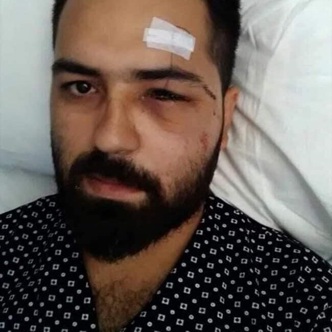 15 Temmuz Gazisi Muhammed Musa Akkoç, “‘Yapmayın, hepimizin çoluğu çocuğu