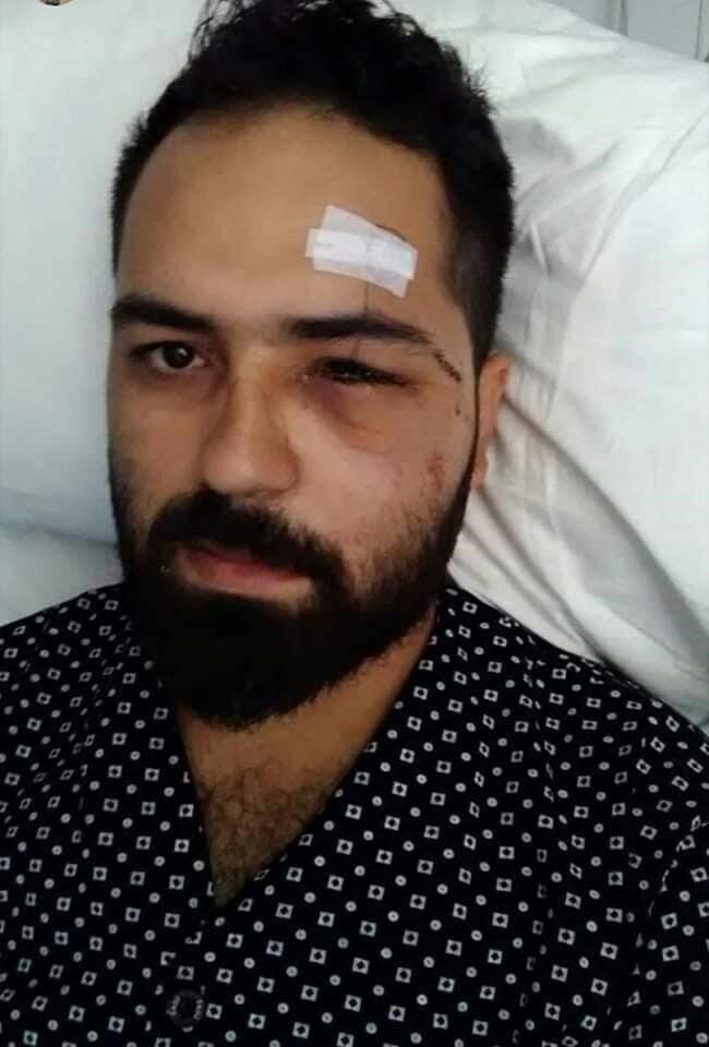 15 Temmuz Gazisi Muhammed Musa Akkoç, “‘Yapmayın, hepimizin çoluğu çocuğu