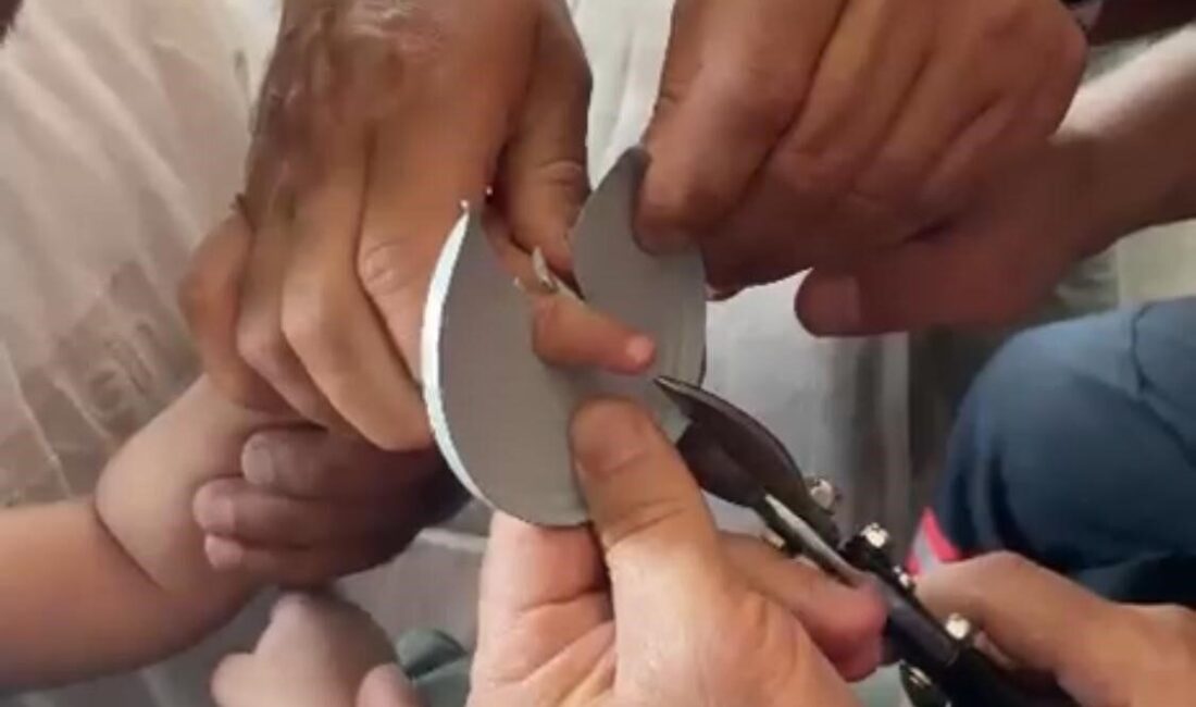 Batman merkezde bir çocuğun eline sıkışan cisim, itfaiye ekibinin müdahalesiyle