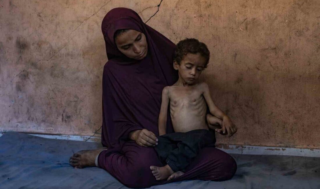 Filistin Sağlık Bakanlığı, Gazze Şeridi’nde 2 kişinin daha açlık nedeniyle