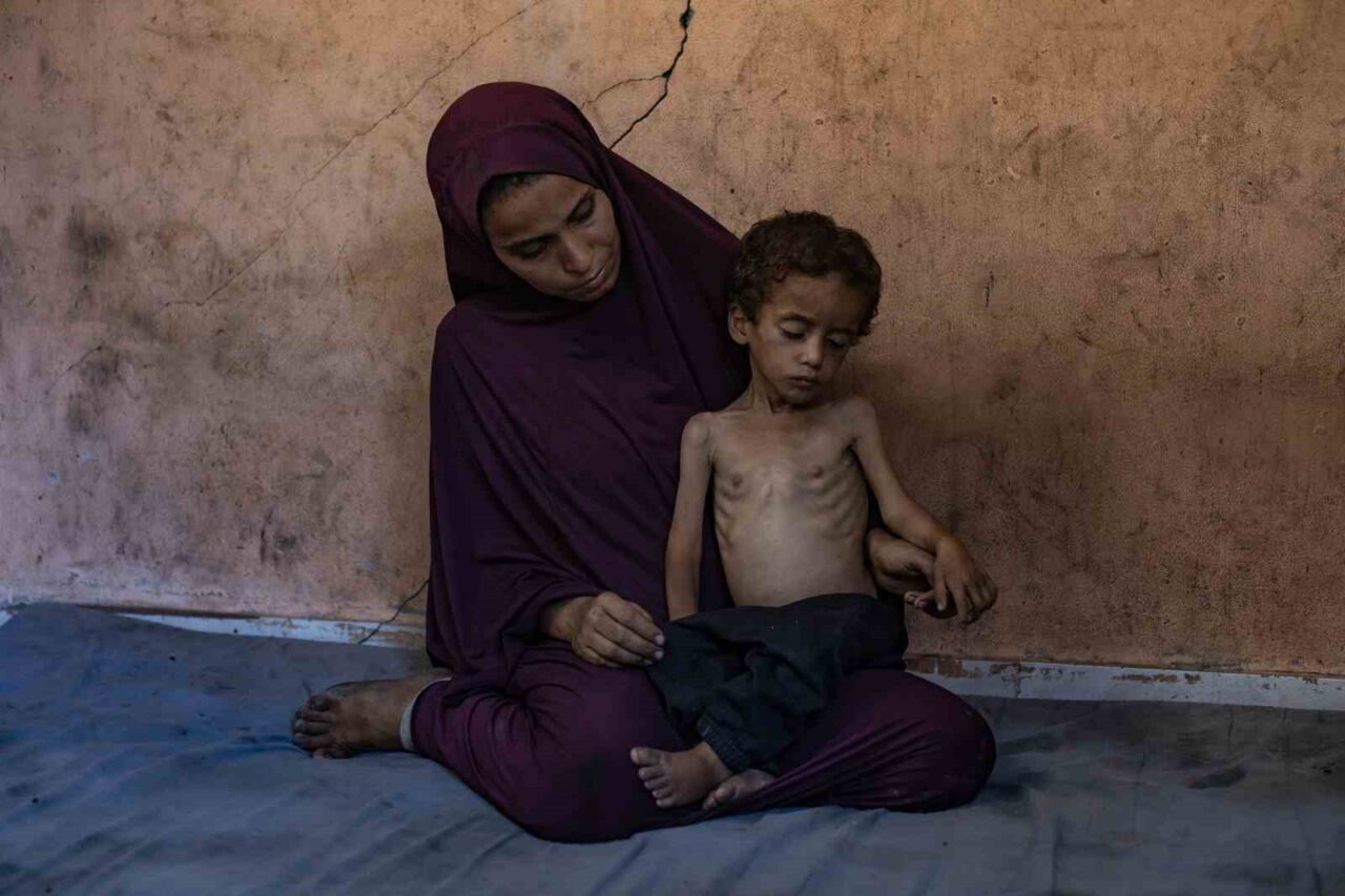 Filistin Sağlık Bakanlığı, Gazze Şeridi’nde 2 kişinin daha açlık nedeniyle