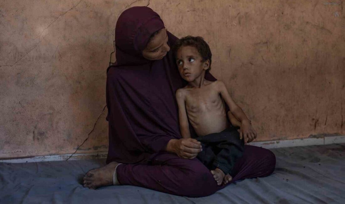 Filistin Sağlık Bakanlığı’ndan yapılan açıklamada, İsrail’in ablukası altındaki Gazze Şeridi’nde