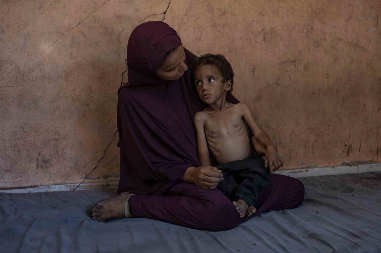 Filistin Sağlık Bakanlığı’ndan yapılan açıklamada, İsrail’in ablukası altındaki Gazze Şeridi’nde
