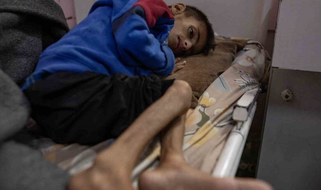 Filistin Sağlık Bakanlığı’ndan yapılan açıklamada, Gazze Şeridi’nde açlık ve yetersiz