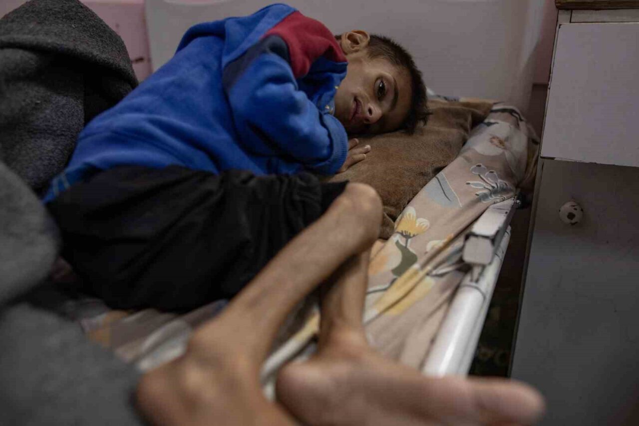 Filistin Sağlık Bakanlığı’ndan yapılan açıklamada, Gazze Şeridi’nde açlık ve yetersiz