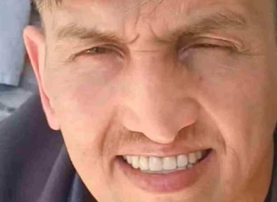 İstanbul’un Tuzla ilçesinde bulunan Özel Tusa Hastanesi’nde burun estetiği ameliyatı