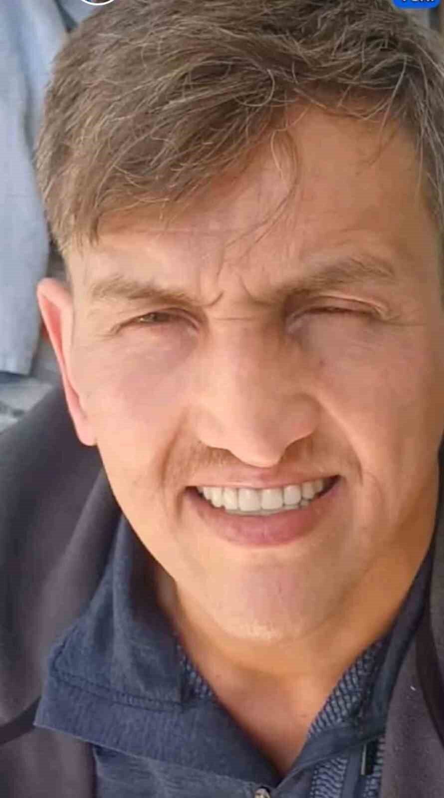 İstanbul’un Tuzla ilçesinde bulunan Özel Tusa Hastanesi’nde burun estetiği ameliyatı