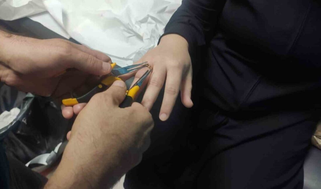 Batman’da bir kadın parmağına sıkışan yüzüğü, itfaiye ekipleri tarafından güçlükle