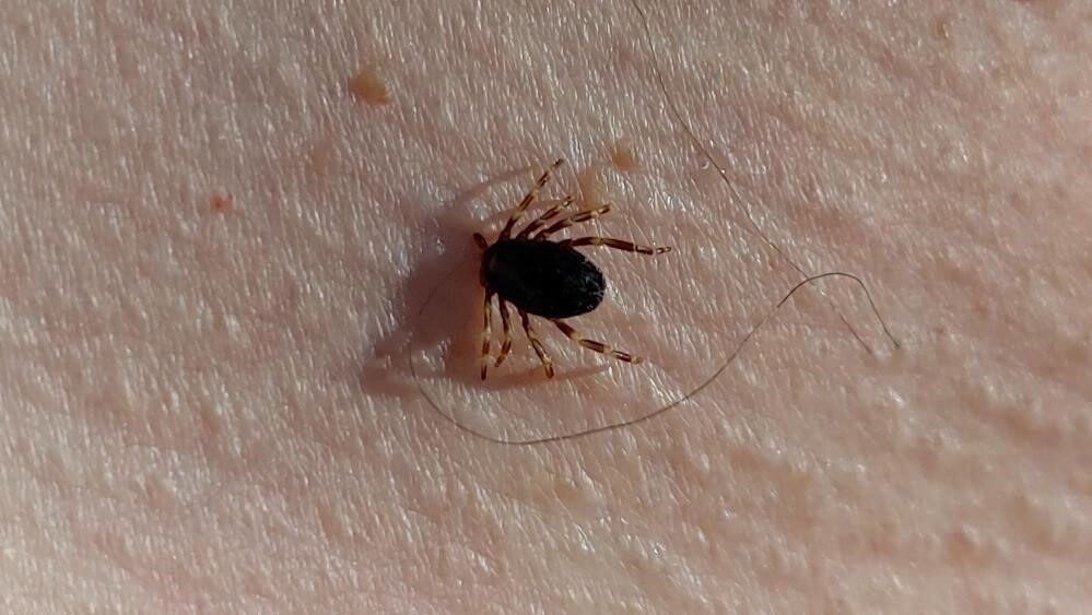 Karadeniz Teknik Üniversitesi (KTÜ) Farabi Hastanesi Enfeksiyon Hastalıkları ve Klinik