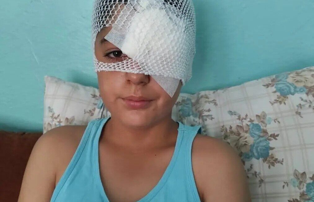 Şanlıurfa’nın Viranşehir ilçesinde kaldırımda yürürken köpek saldırısından kaçan çocuğa otomobil