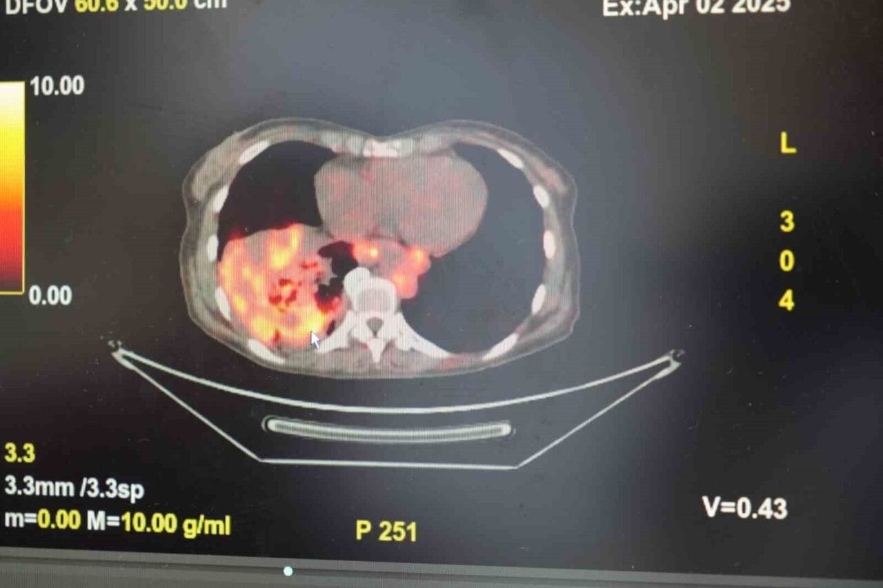 Göğüs Hastalıkları Uzmanı Prof. Dr. Şevket Özkaya, son yıllarda sigara