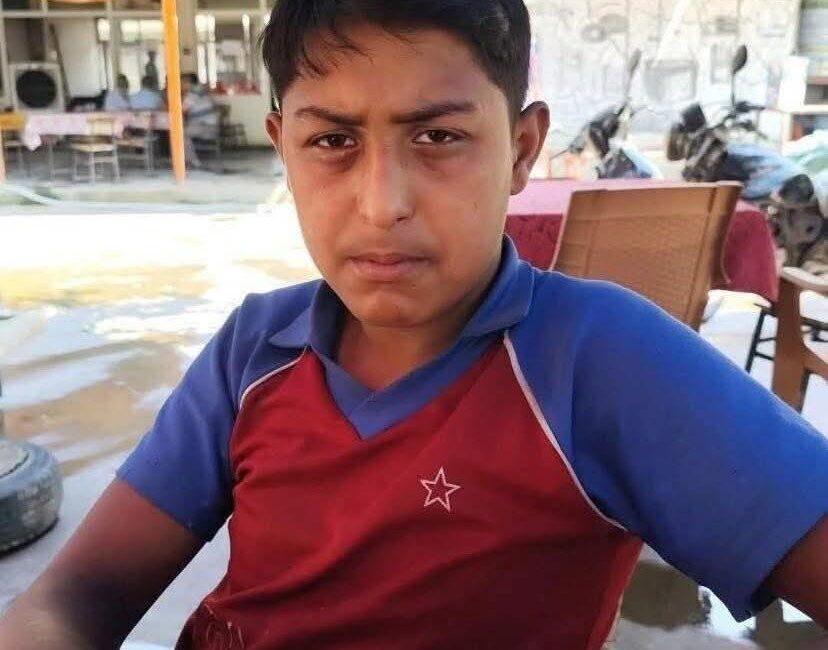 Aydın’ın İncirliova ilçesinde çıkan kavgada başına aldığı darbeler sonucu yaralanan