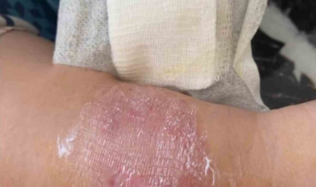 İstanbul’un Büyükçekmece ilçesinde, plajda kadınlar arasında çıkan ’sigara dumanı’ tartışması