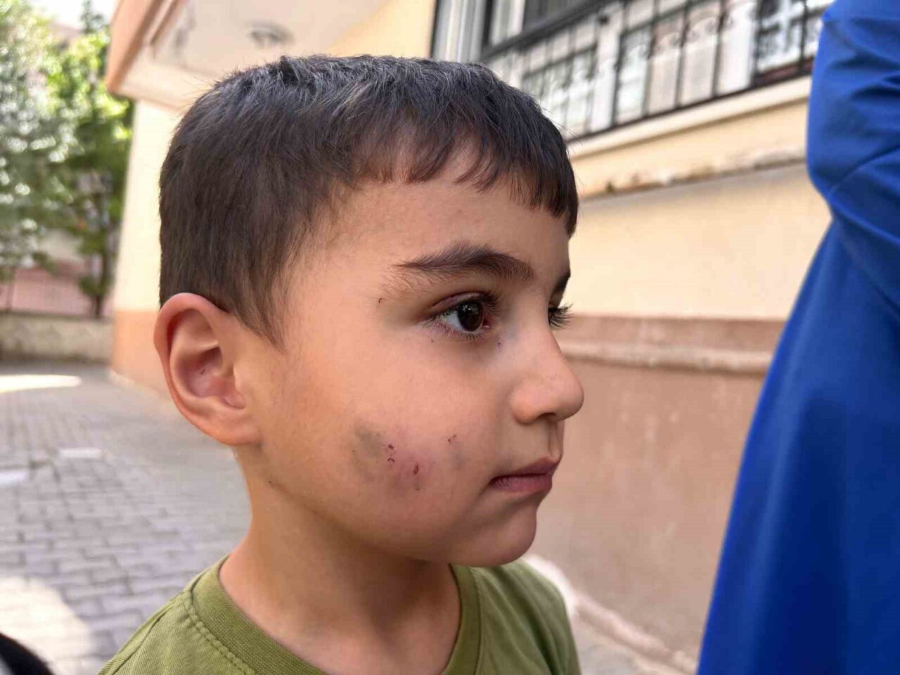 Ankara’nın Sincan ilçesinde evde uyurken lağım faresi tarafından ısırılarak yaralanan