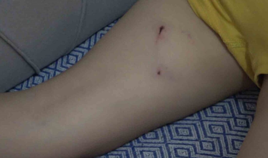 Rize’de 5 yaşındaki bir çocuk babasının yanında başıboş sokak köpeğinin