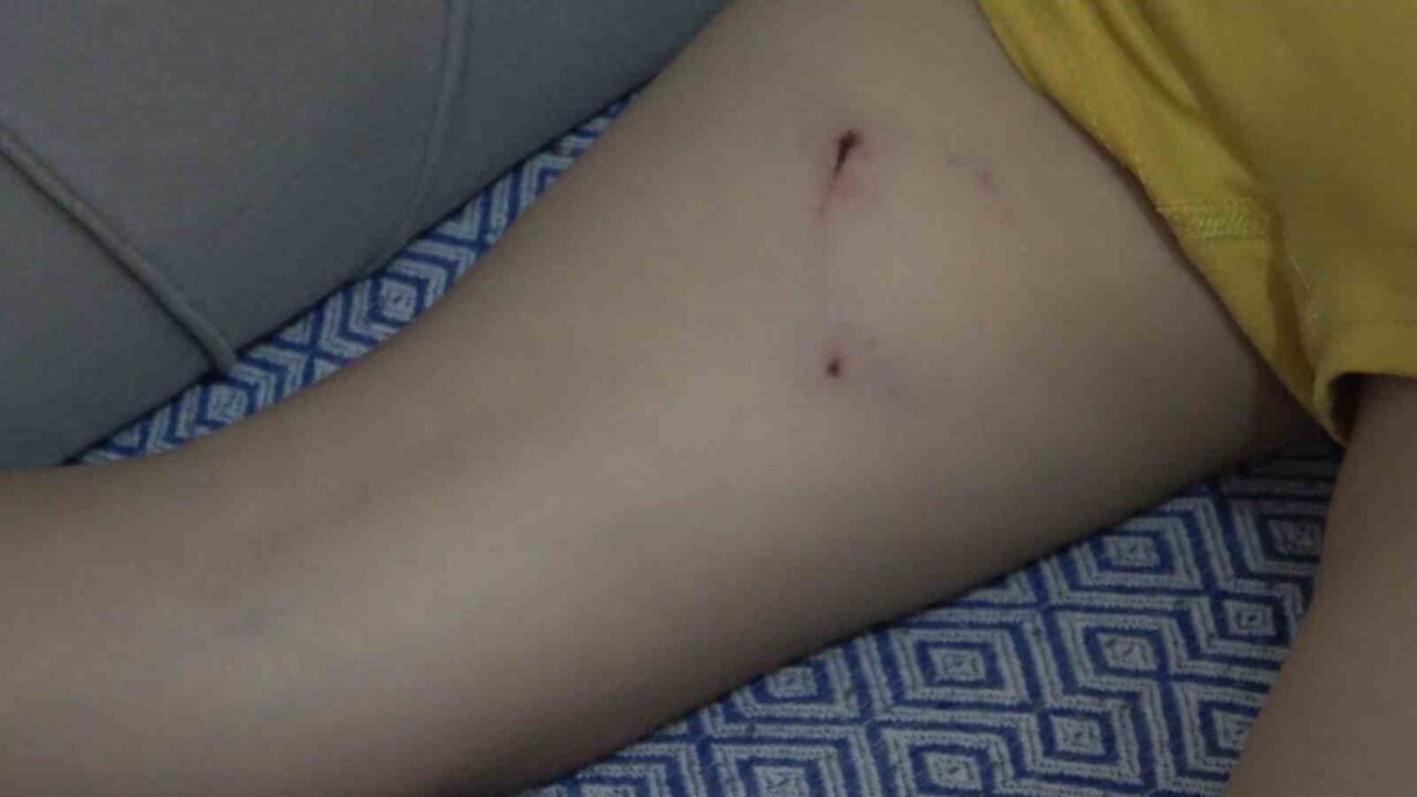 Rize’de 5 yaşındaki bir çocuk babasının yanında başıboş sokak köpeğinin