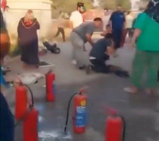 Kahramanmaraş’ın Türkoğlu ilçesinde konteynerde çıkan yangında yaralanan 3 yaşındaki çocuk