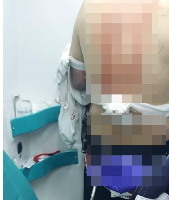 İstanbul Avcılar’da ekmek almaya gittiği esnada sokakta kardeşi tarafından silahla