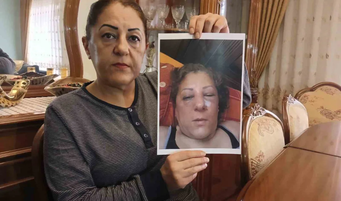 Ankara’da ikamet ettiği apartmanın bahçesinde beslediği kediler nedeniyle husumetli olduğu