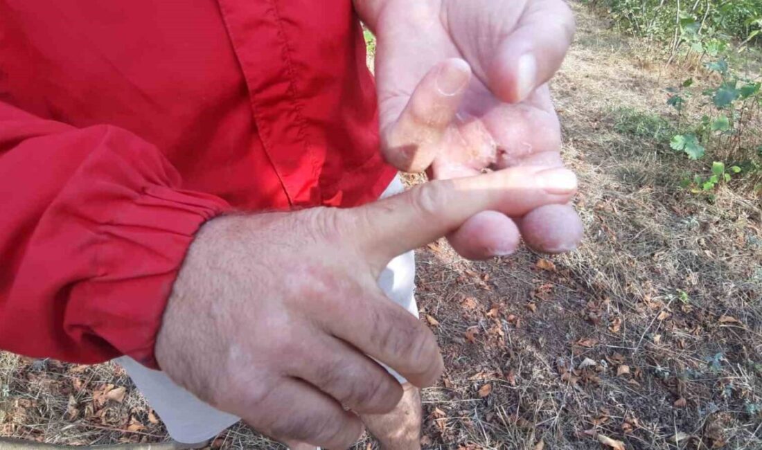 Bolu’nun Mudurnu ilçesinde fındık bahçesinde ayının saldırdığı kişi, bir parmağını