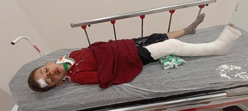 İstanbul Başakşehir’de ailesiyle birlikte vakit geçiren 8 yaşındaki çocuğa, trafiğe