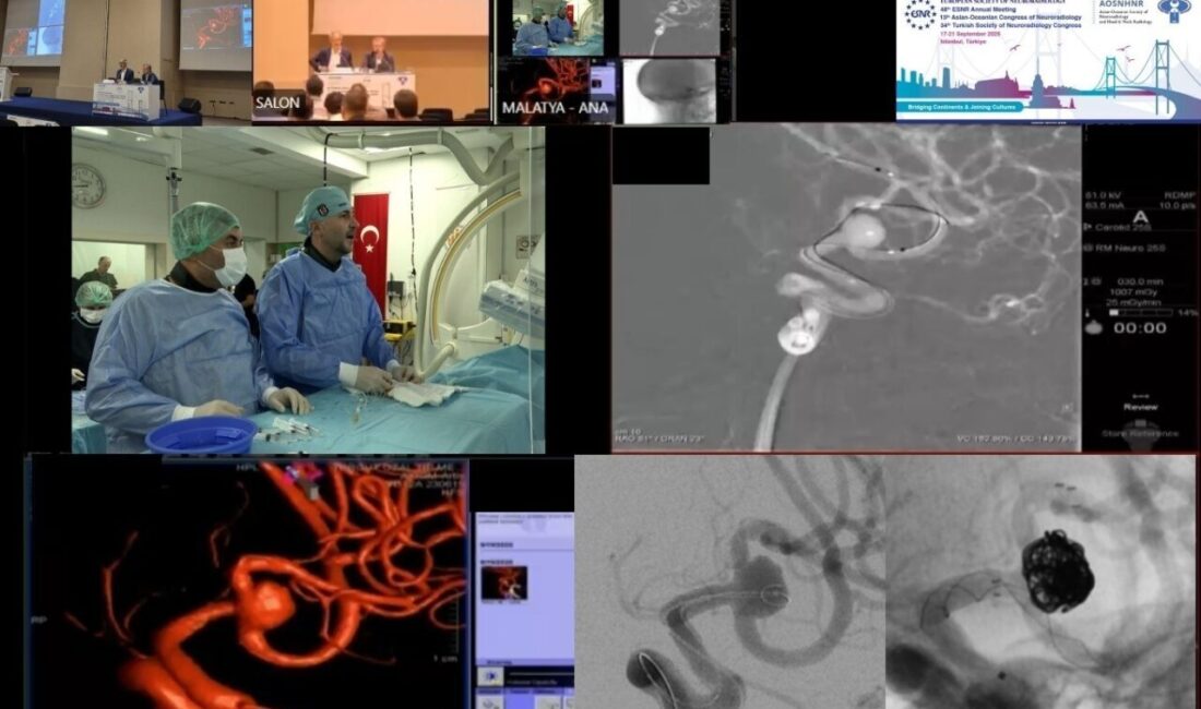 İstanbul’da 17-21 Eylül tarihleri arasında düzenlenen Asya ve Avrupa Nöroradyoloji