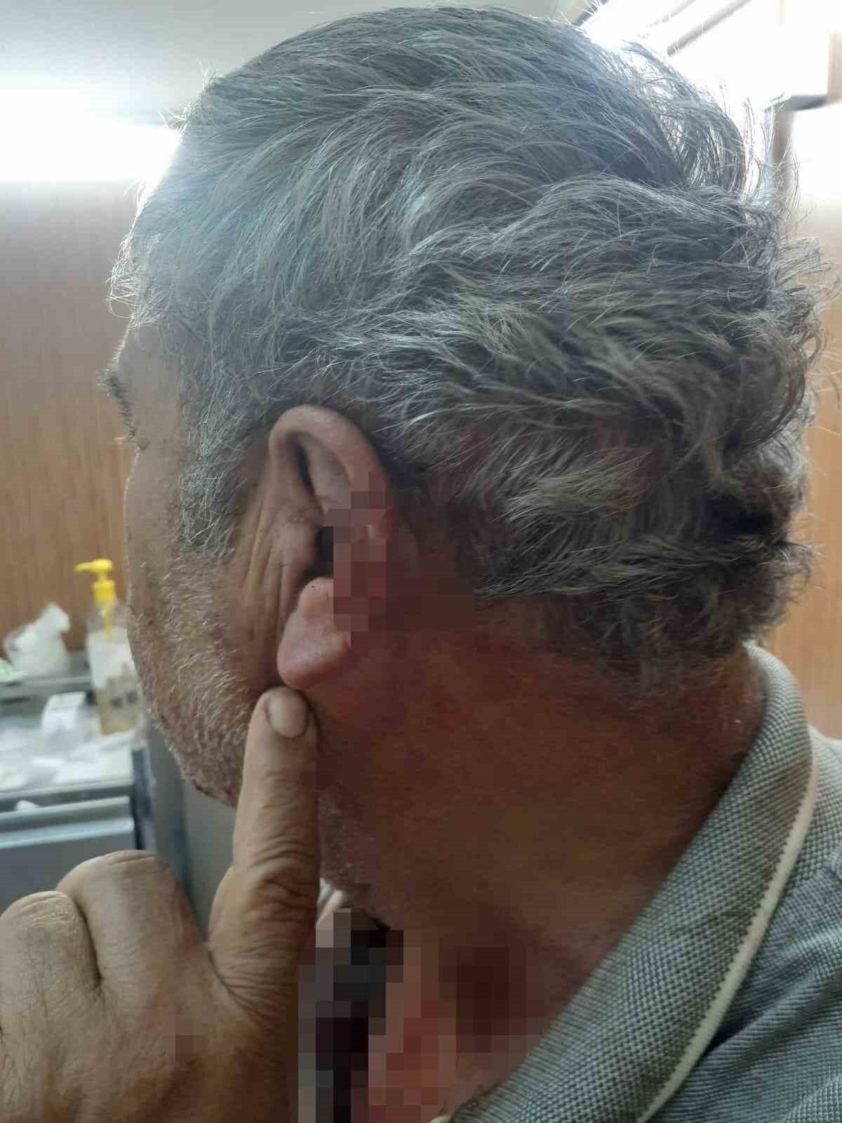 Denizli’nin Acıpayam ilçesinde aile hekimi ile emekli öğretmen arasında yaşanan