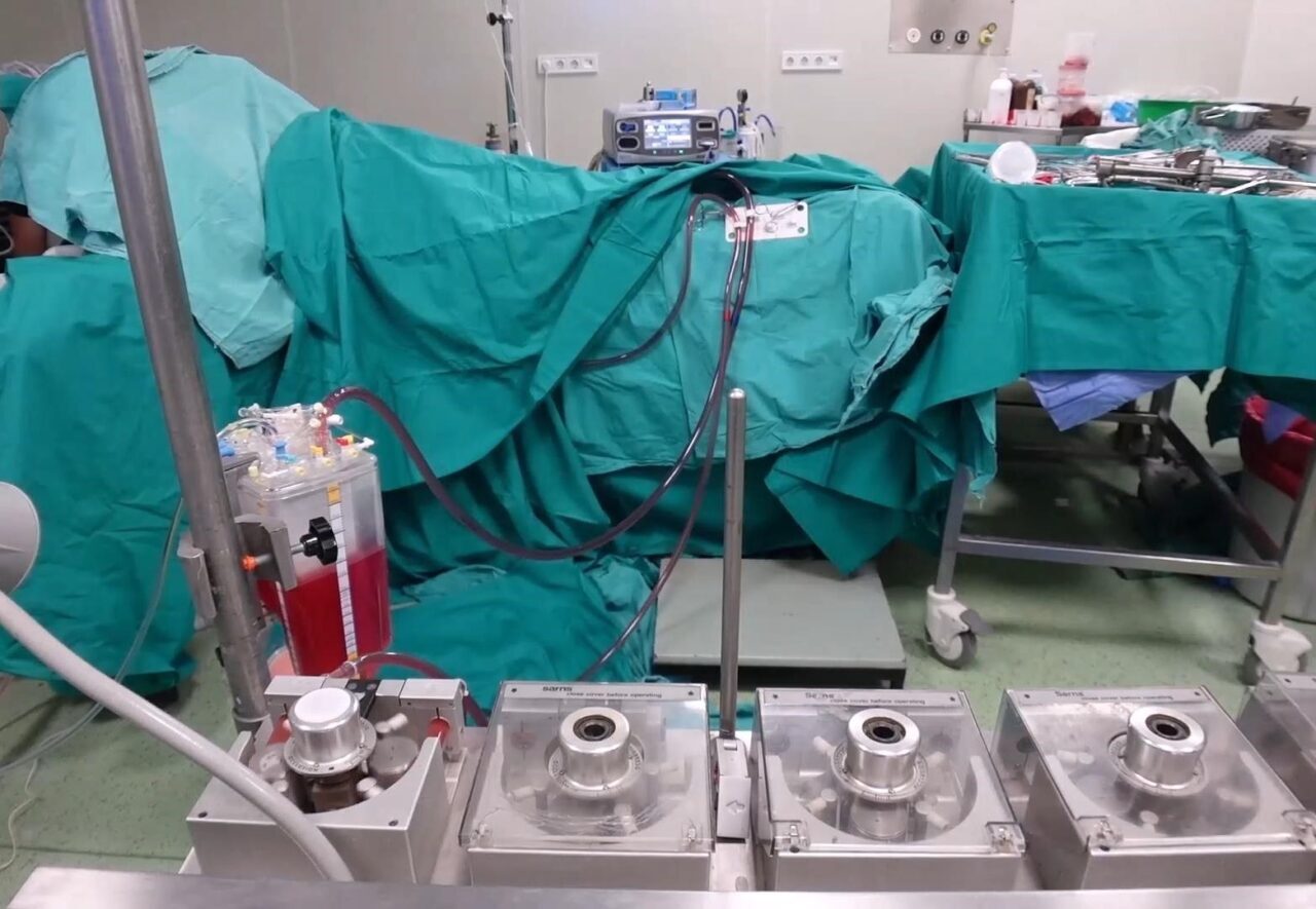 Elazığ Fırat Üniversitesi Hastanesi’nde Hipertermik Intraperitoneal Kemoterapi (HIPEC) yöntemiyle kanser