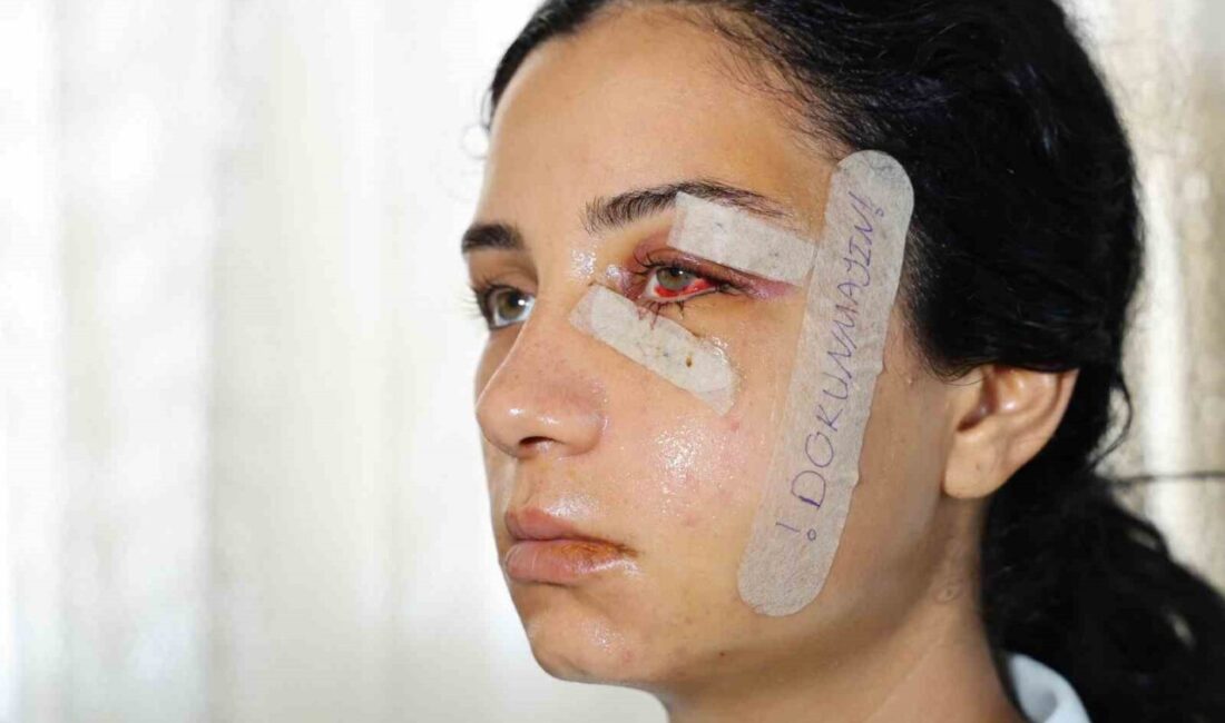 Adana’da eski eşini dövdükten sonra gözaltına alınıp serbest bırakılan şahıs,