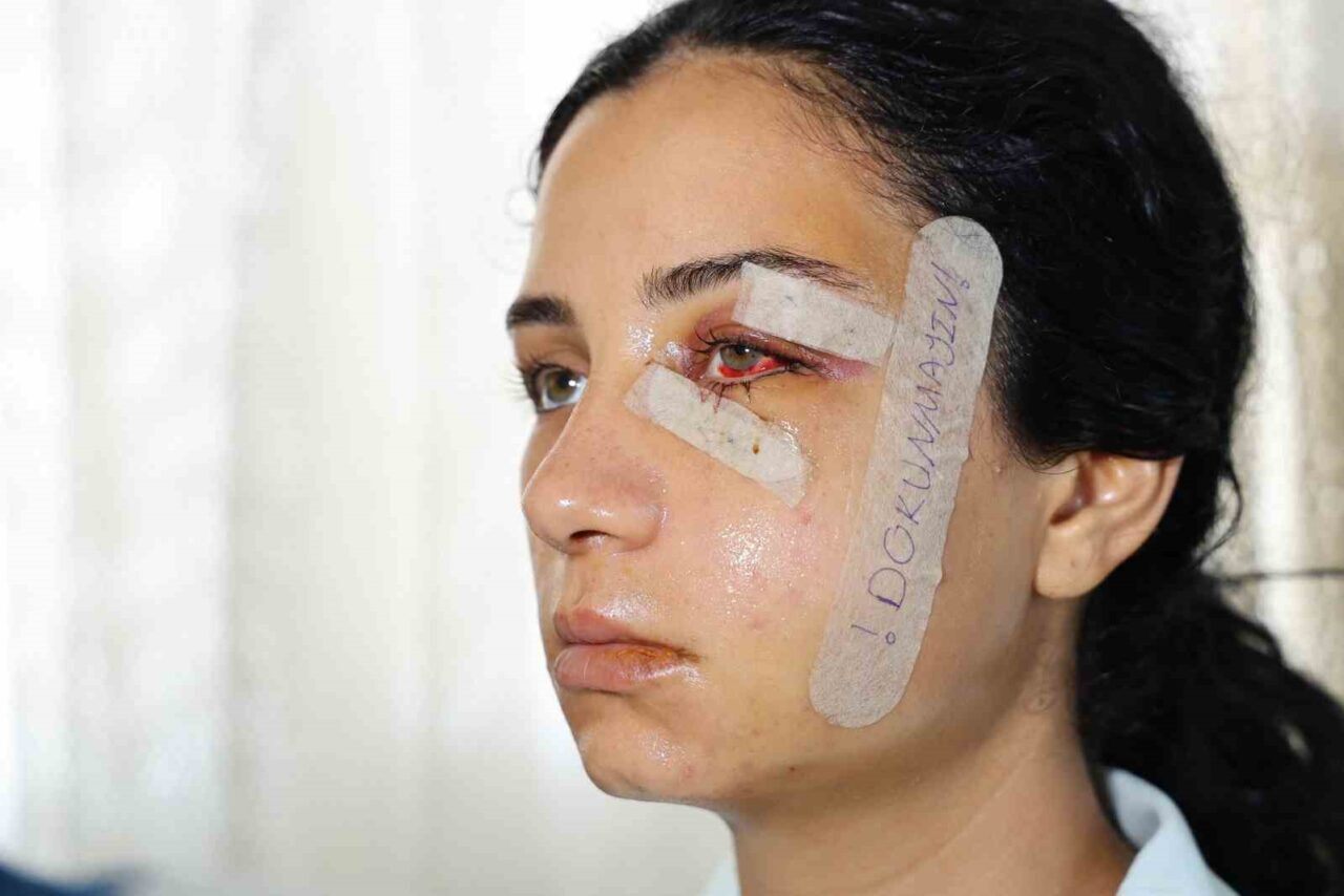 Adana’da eski eşini dövdükten sonra gözaltına alınıp serbest bırakılan şahıs,