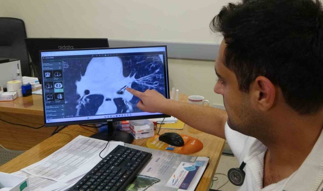 Malatya’da bir buçuk yıldır geçmeyen öksürük şikayetiyle birçok hastaneye başvuran