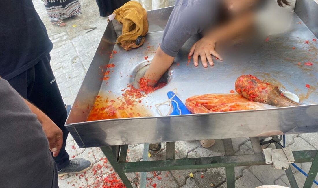 Şanlıurfa’da 16 yaşındaki kız çocuğunun salça makinesi merdanesine kaptırdığı eli,