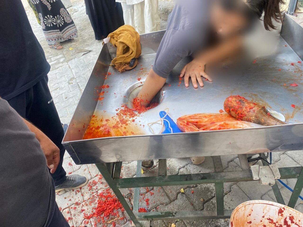 Şanlıurfa’da 16 yaşındaki kız çocuğunun salça makinesi merdanesine kaptırdığı eli,