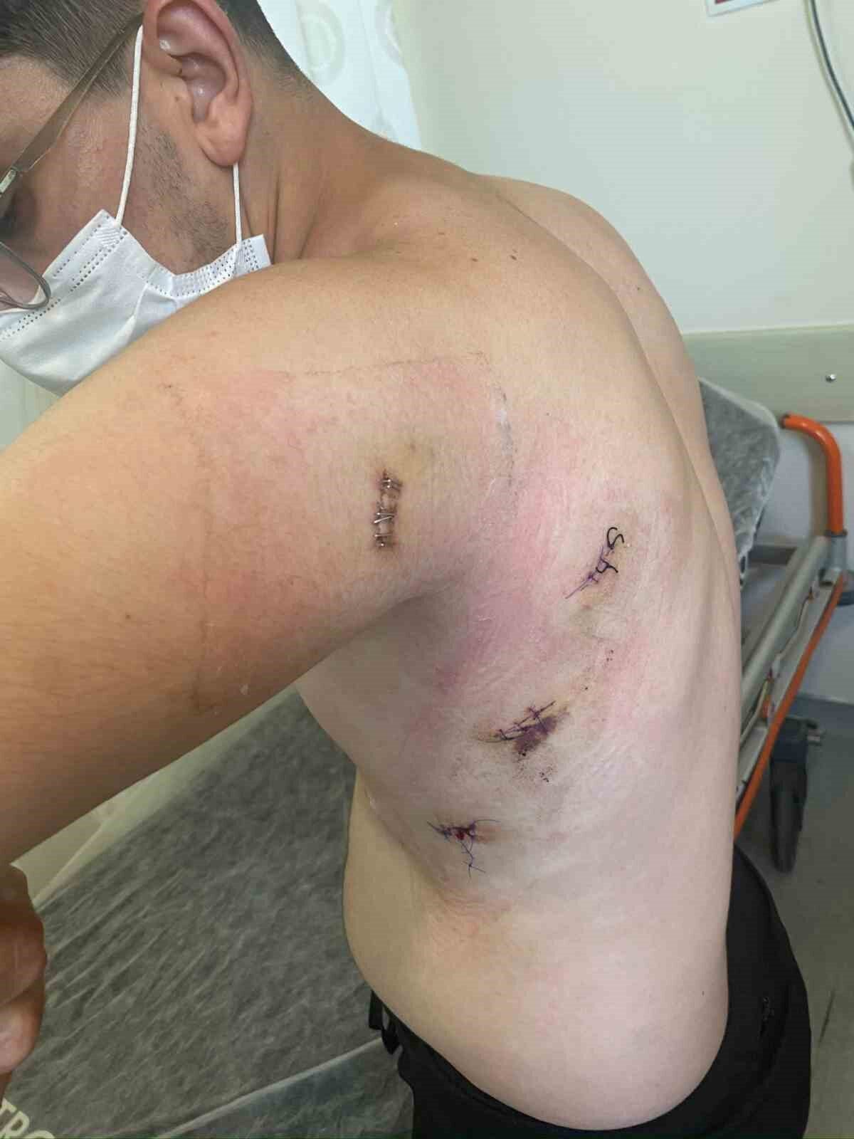 Sakarya’nın Ferizli ilçesinde kız kardeşini sözlü taciz ettiği ileri sürülen