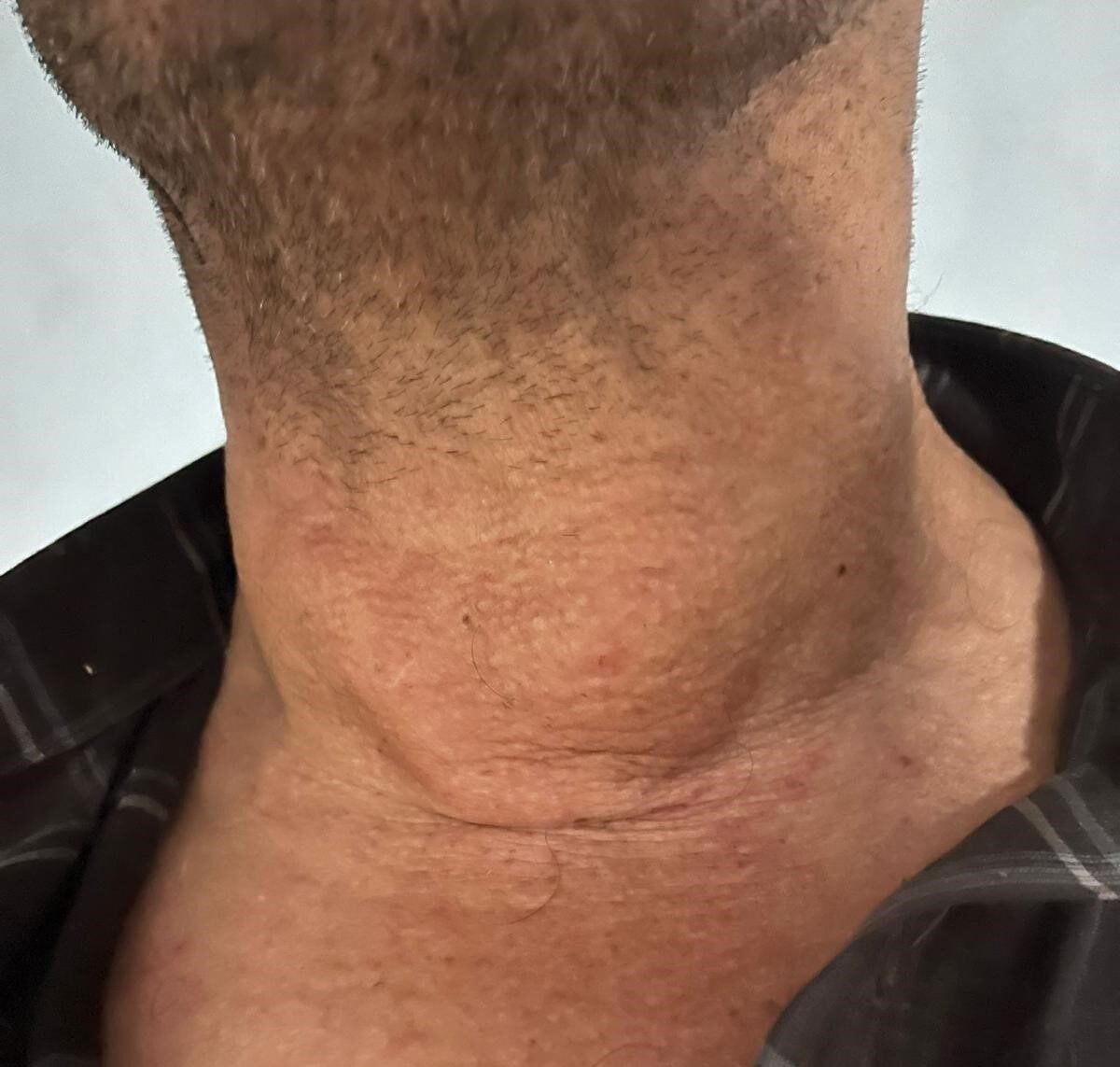 Kütahya Evliya Çelebi Eğitim Araştırma Hastanesi Girişimsel Radyoloji Biriminde olağanüstü