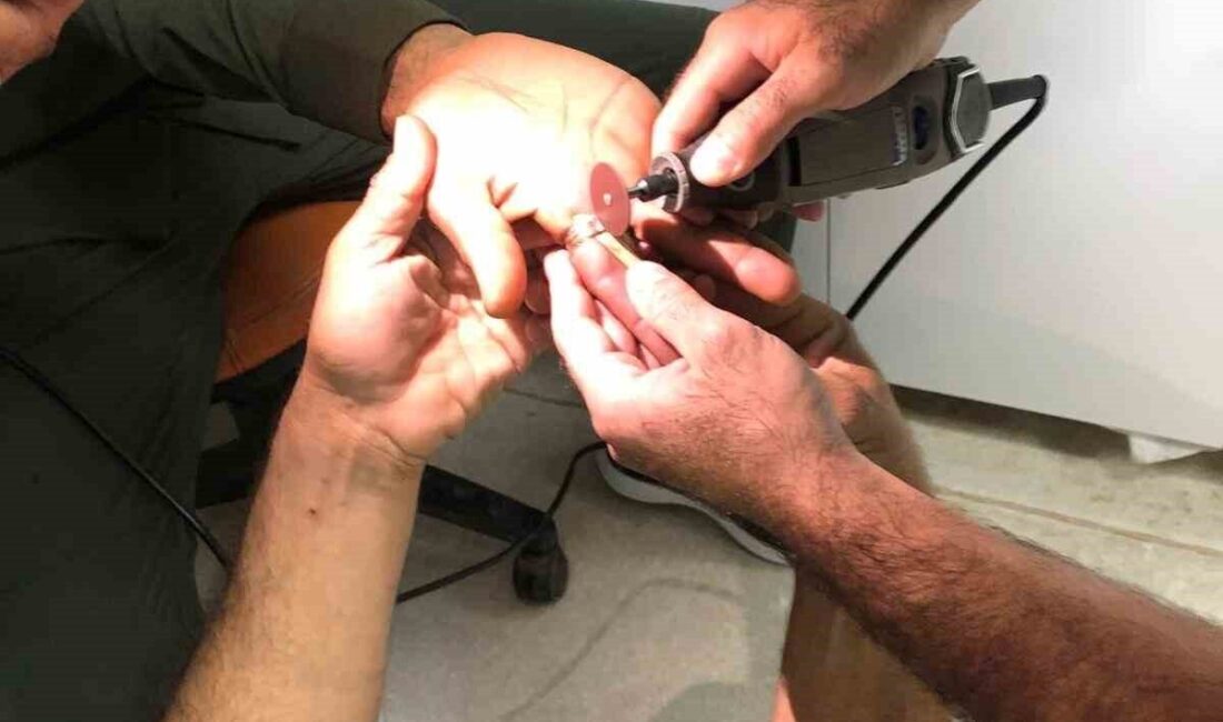 Mardin’in Derik ilçesinde bir kişinin parmağına sıkışan yüzük, hastanede itfaiye