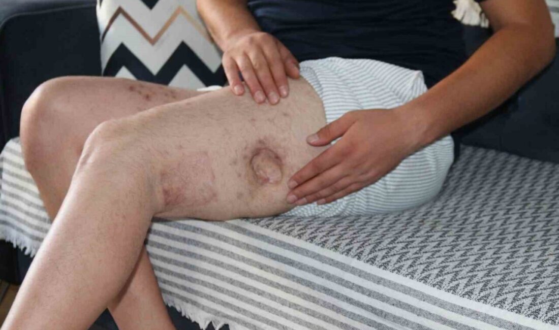 Eskişehir’de akrabası tarafından tüfekle vurulan 30 yaşındaki adam, ilk verdiği