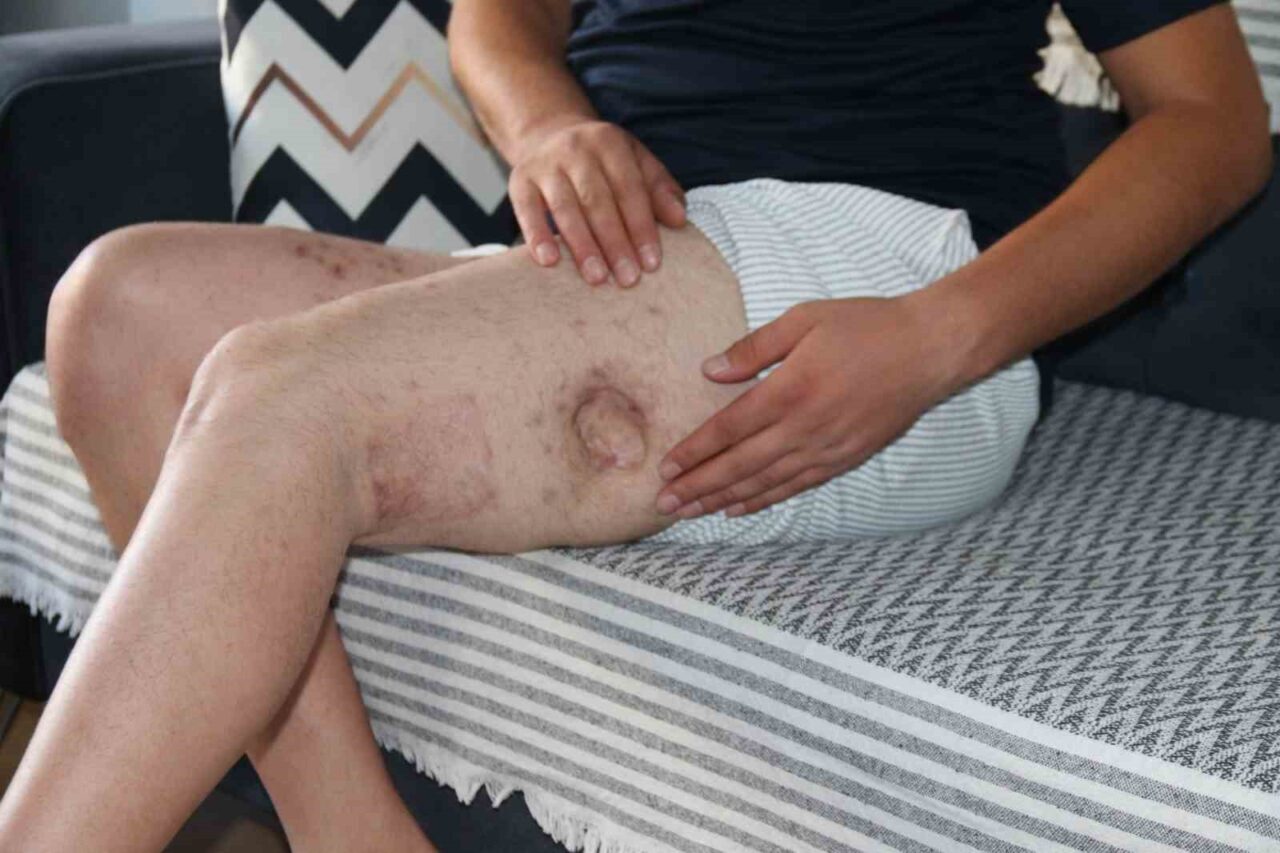 Eskişehir’de akrabası tarafından tüfekle vurulan 30 yaşındaki adam, ilk verdiği