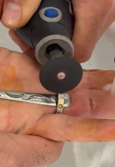 Kastamonu’da bir kadının parmağına sıkışan yüzük, itfaiye ekibince kesilerek çıkartıldı.