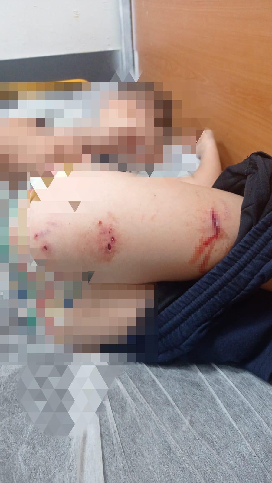 DİYARBAKIR (İHA) – Diyarbakır’da sokak köpeklerinin saldırısı sonucu 9 yaşındaki