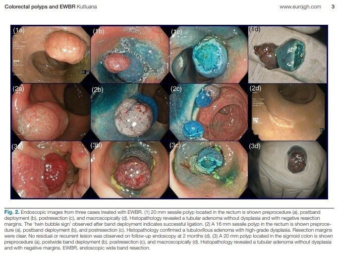 DENİZLİ (İHA) –Denizli’de İç Hastalıkları Anabilim Dalı Gastroenteroloji Bilim Dalı