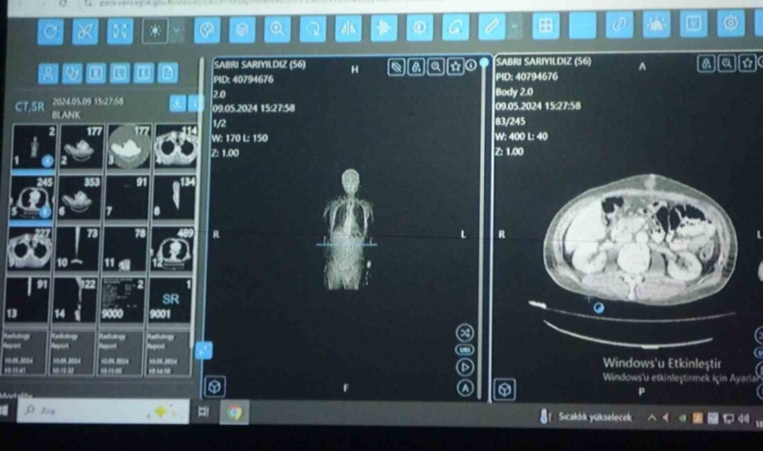 Sağlık Bilimleri Üniversitesi (SBÜ) Van Bölge Eğitim ve Araştırma Hastanesi’nde