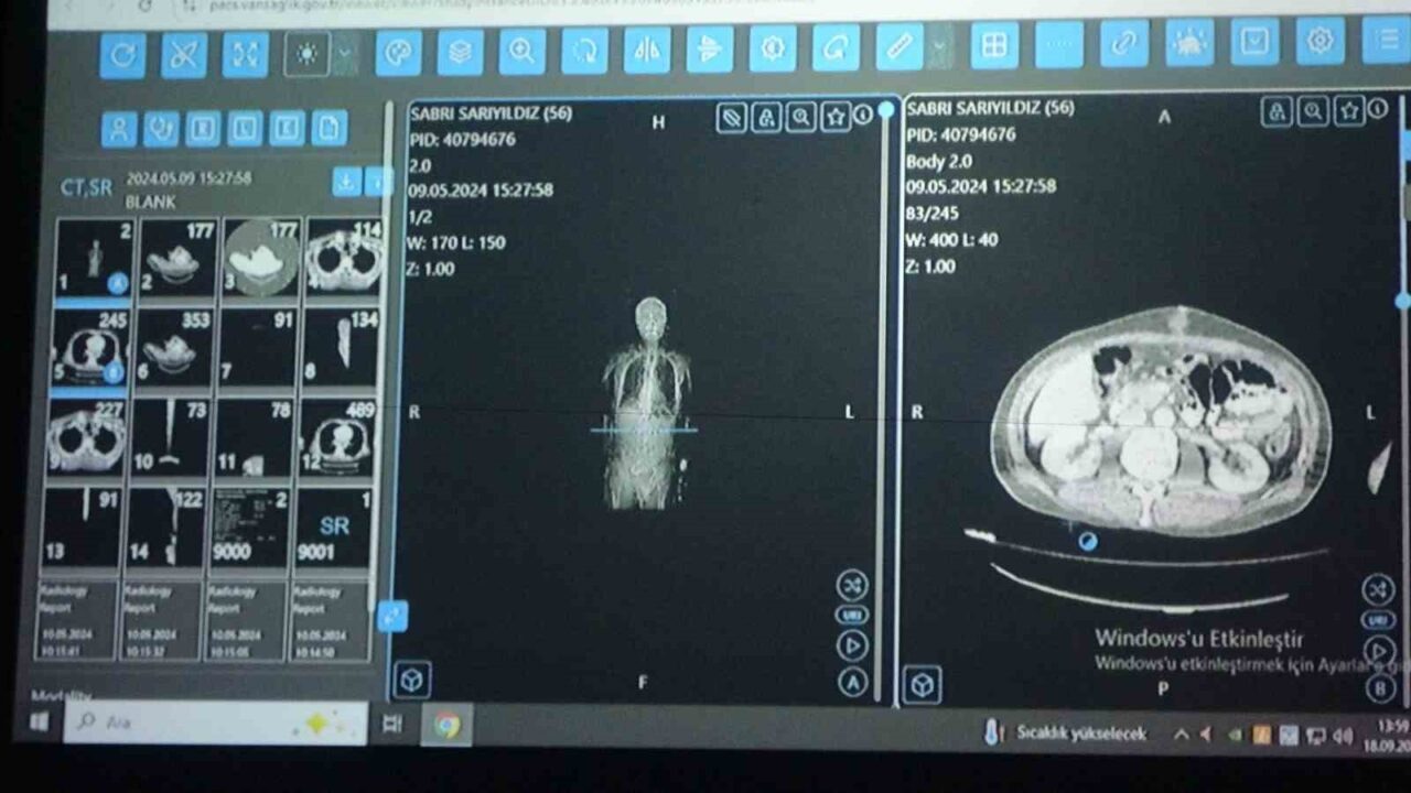 Sağlık Bilimleri Üniversitesi (SBÜ) Van Bölge Eğitim ve Araştırma Hastanesi’nde