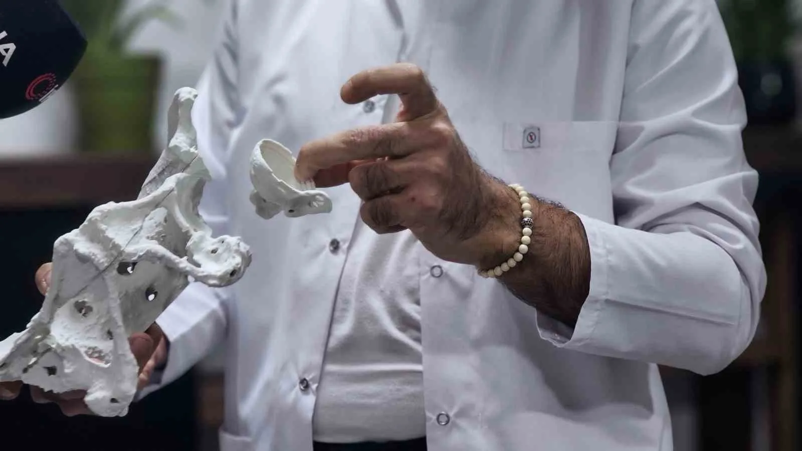 Zonguldak’ın Ereğli ilçesinde 60 yaşındaki bir kadın hastaya, 3D yazıcı