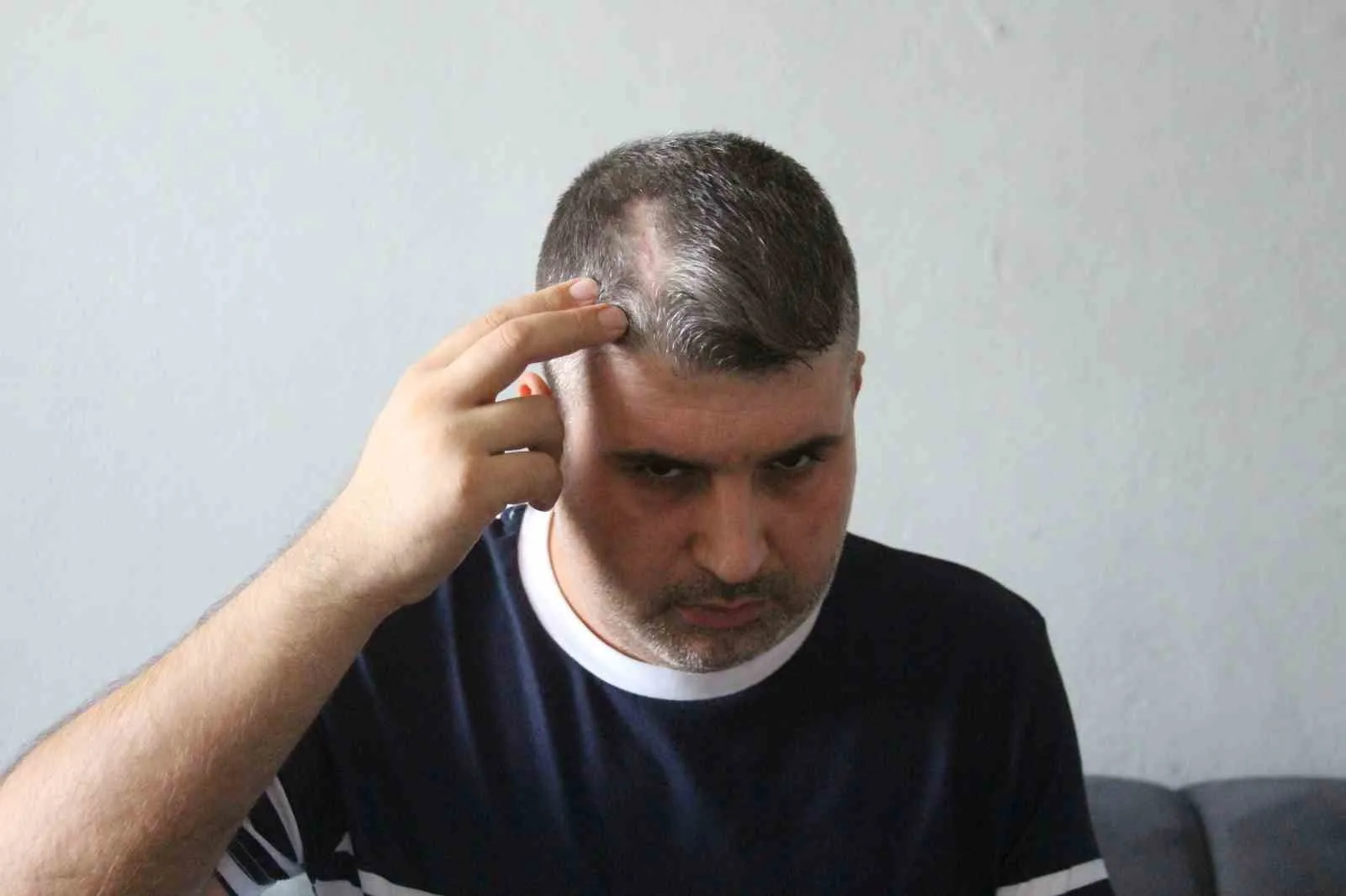 Adana’da dayısının beyzbol sopalı saldırısına uğrayarak ölümden dönen Mehmet Alpaltun,