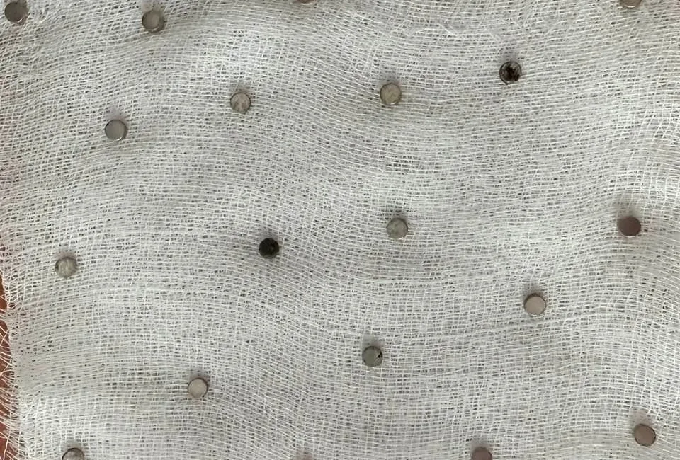 Elazığ’da 3 yaşındaki bir çocuğun yuttuğu 19 mıknatıs, Fırat Üniversitesi