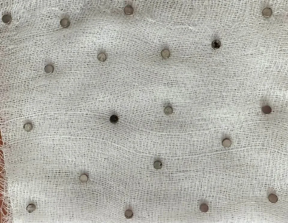 Elazığ’da 3 yaşındaki bir çocuğun yuttuğu 19 mıknatıs, Fırat Üniversitesi