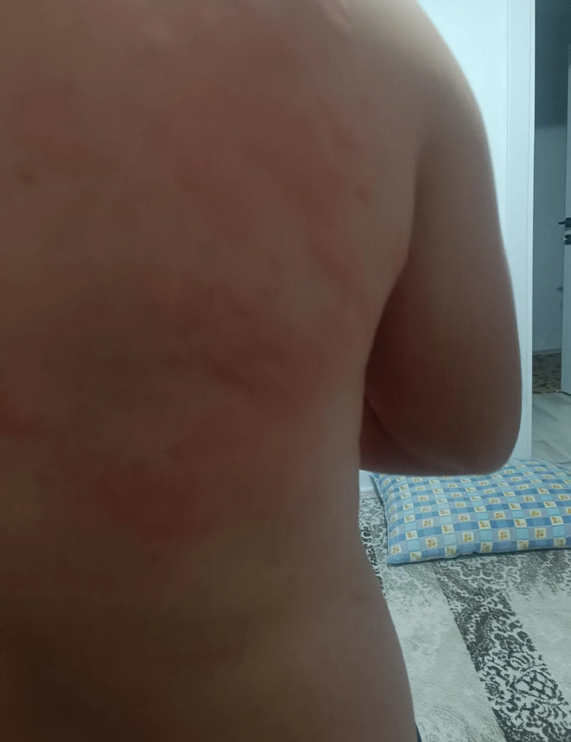 Elazığ’ın Karakoçan ilçesinde yaşayan bir şahıs, iş yerinde çalışırken böcek