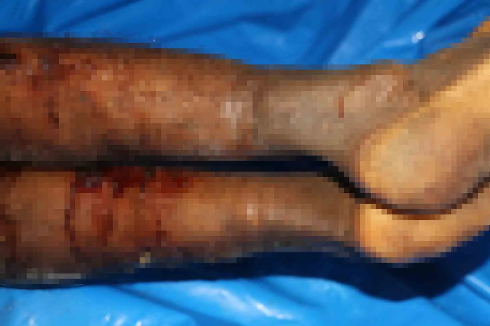 İsrail tarafından iade edilen Filistinlilerin cenazelerinde işkence izleri tespit edildi.