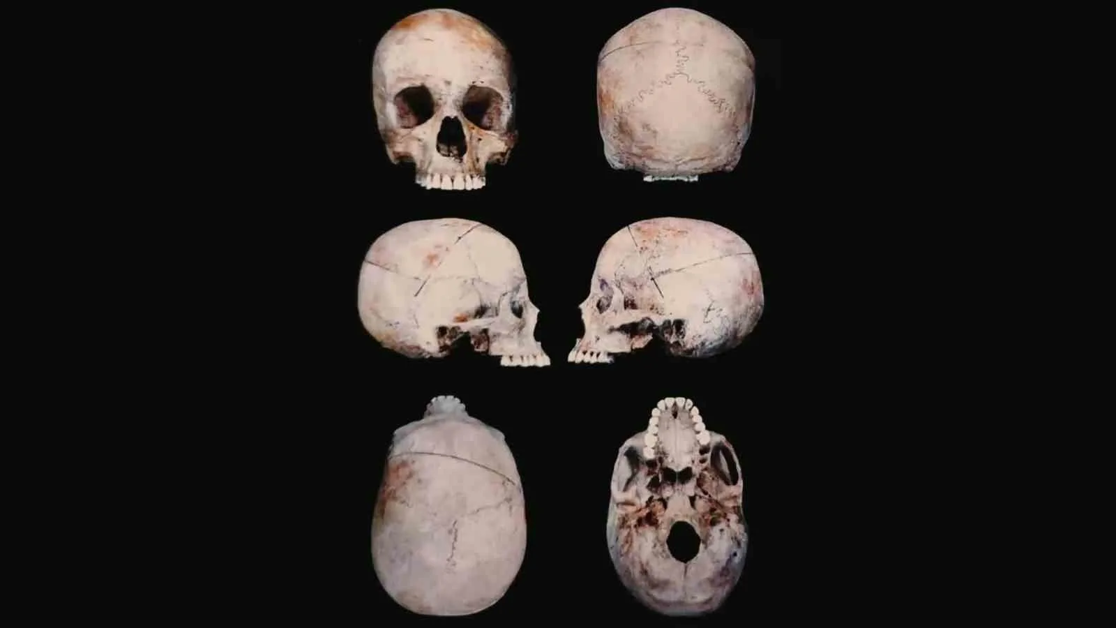 Diyarbakır’ın Çermik ilçesinde 10 yıl önce kaya kovuğundan çıkan kadına